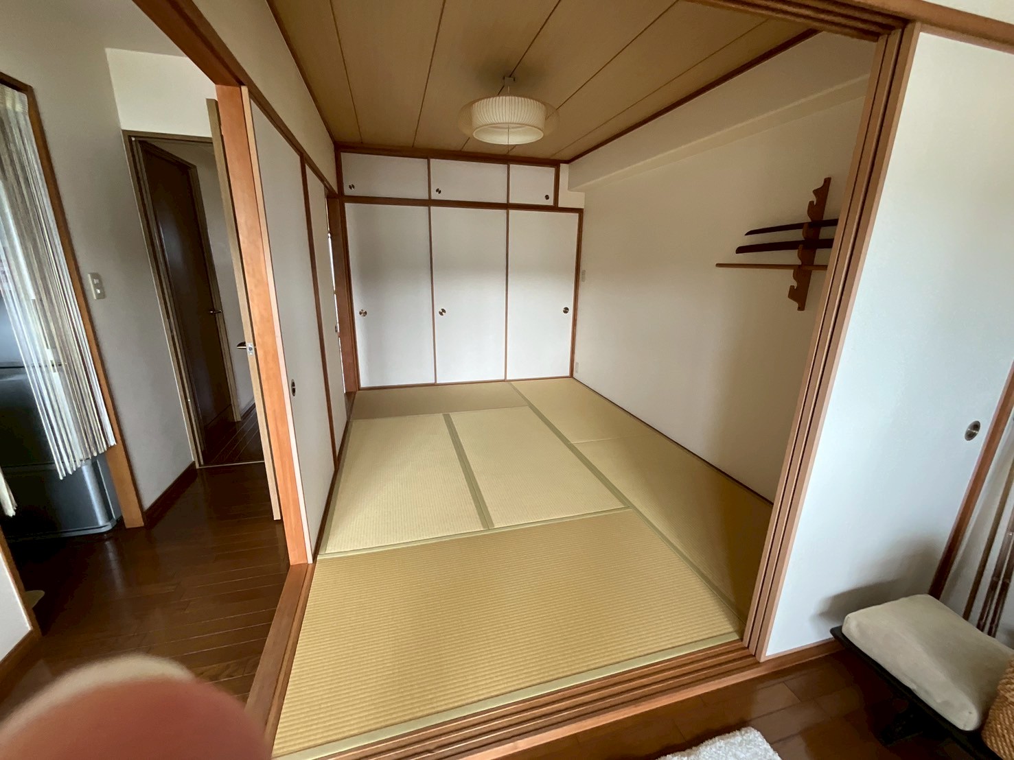 After画像